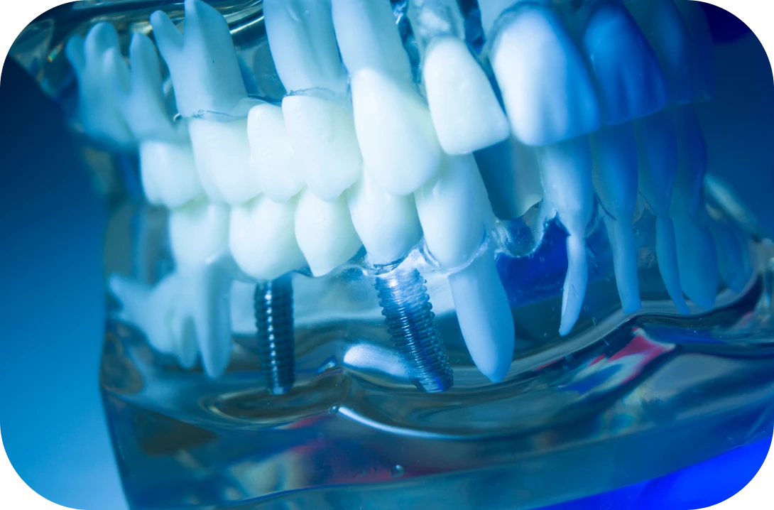 予防歯科について