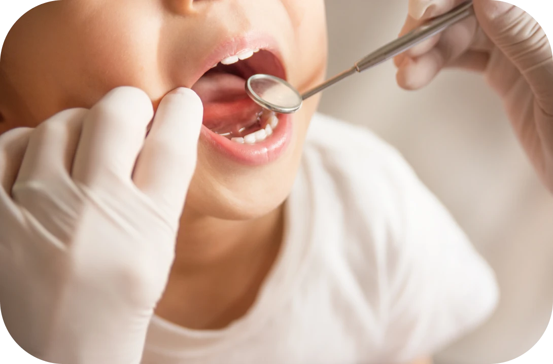 虫歯予防の大切さを伝えましょう