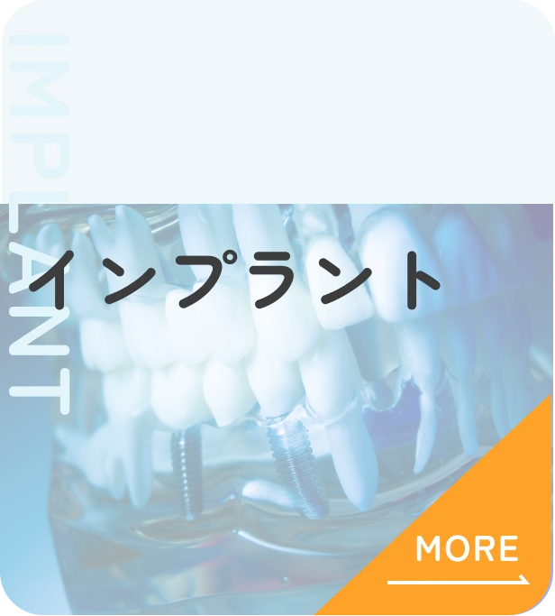 インプラント
